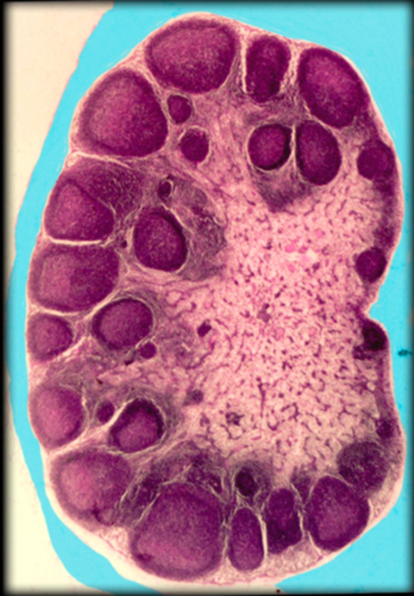 <p>Lymph node</p>