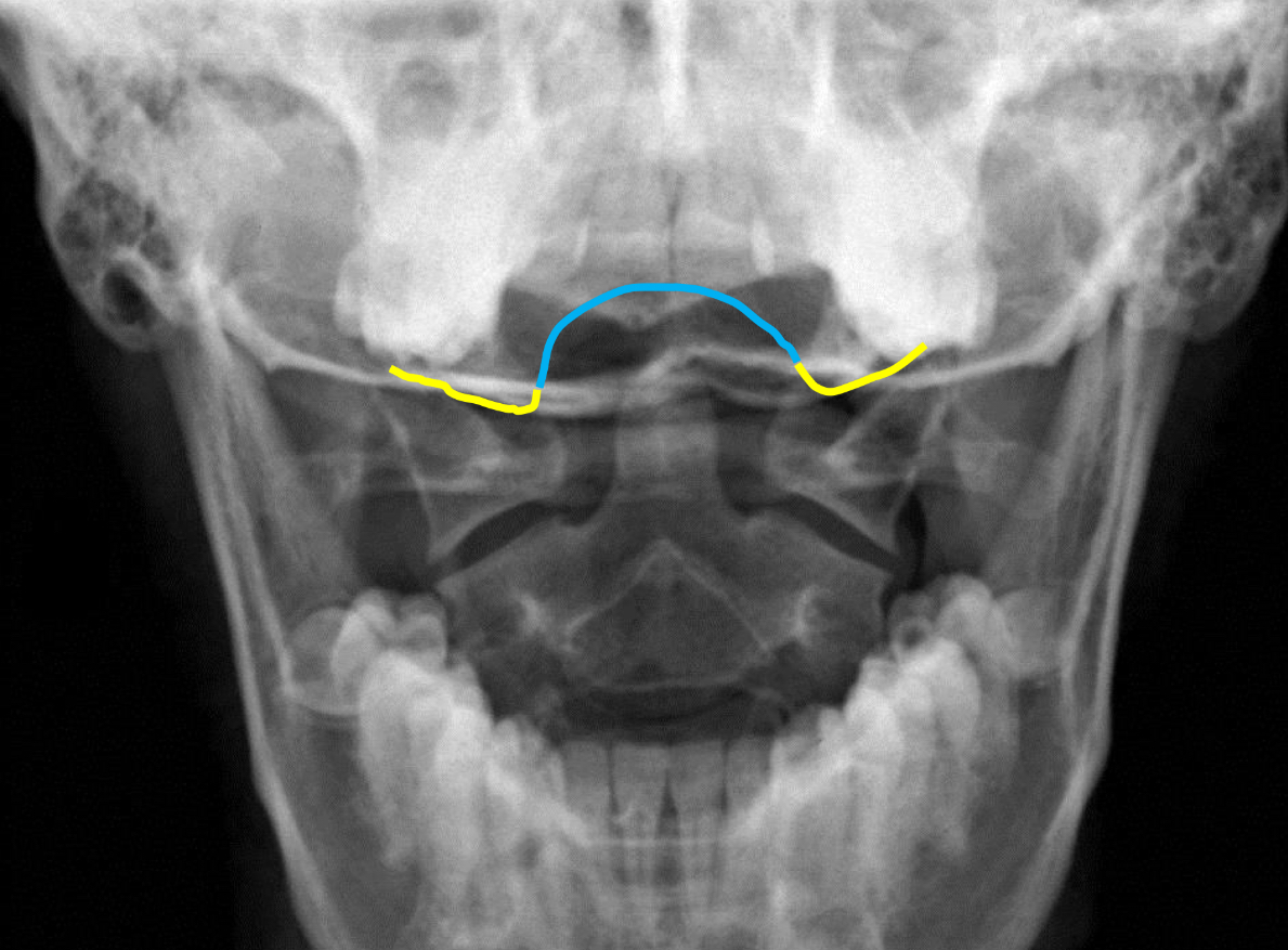 <p>What landmark is indicated in <strong>yellow?</strong></p>