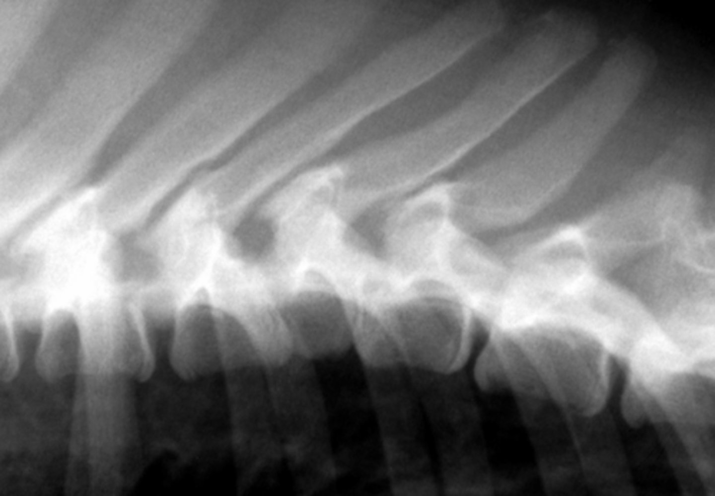 <p>Abnormal shape, usually smaller and wedge shaped on lateral, curving the spine</p>