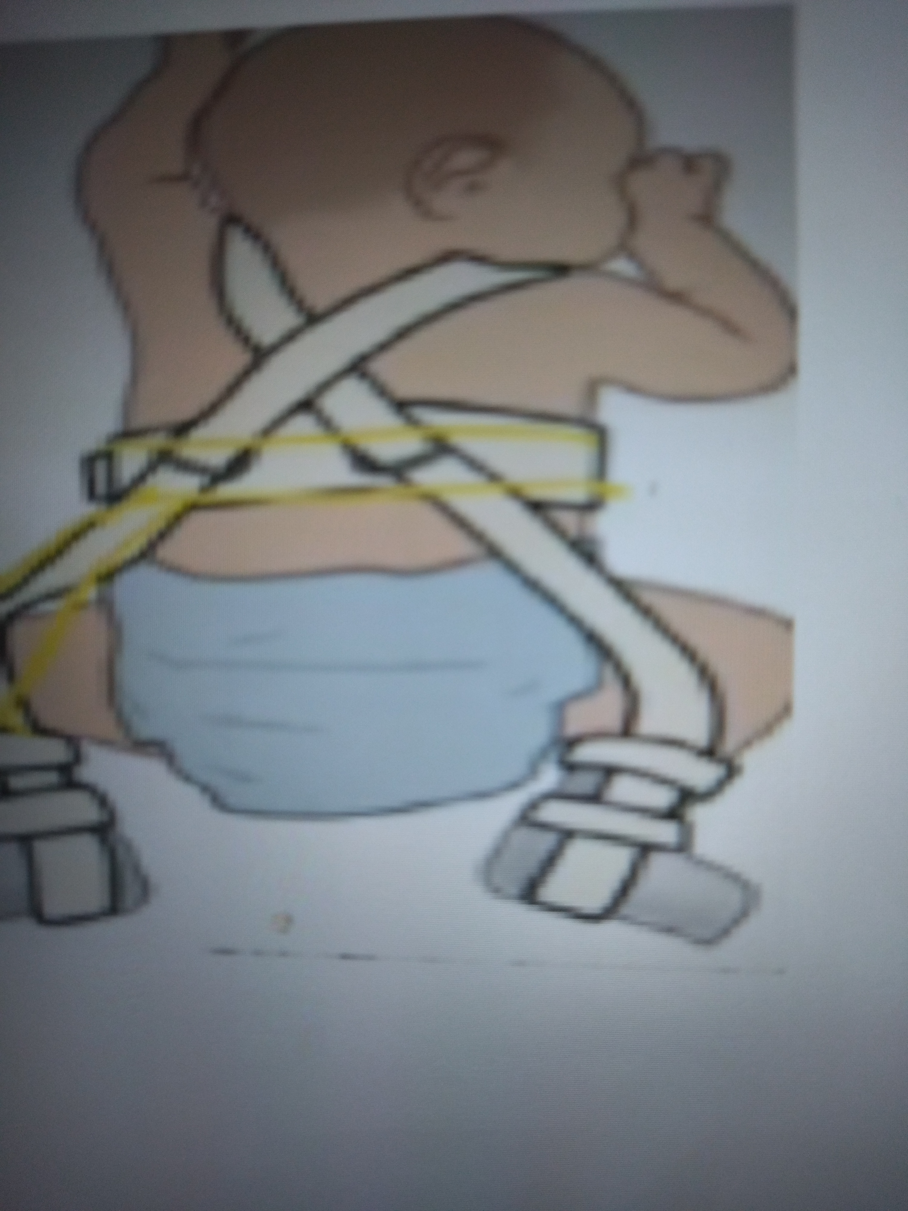 * Has shoulder harness, chest strap, and anterior & posterior strap
* Has no rigid component
* Has greatest mobility among all of them