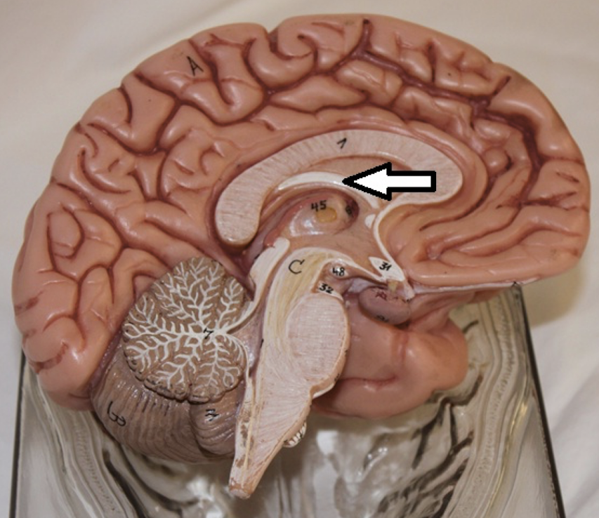 <p>identify the structure</p>
