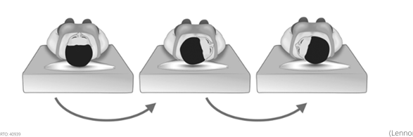<ul><li><p>Assessment for Horizontal Canal BPPV</p></li></ul><ol><li><p>Patient lying supine with 30deg head flexion → on pillow</p></li><li><p>Rotate patients head 90deg to <strong>affected </strong>side. Observe nystagmus and symptoms, hold for 1 minute.</p></li><li><p>Turn head back to midline. Hold for 1 minute</p></li><li><p>Rotate patients head 90→ to <strong>unaffected </strong>side. Observe again. Hold for 1 minute</p></li></ol><p></p><p>Horizontal Canalithiasis→ geotropic and greater nystagmus intensity&nbsp;</p><p>horizontal Cupulothiasis→ apogeotropic and lesser nystagmus intensity</p><p></p>