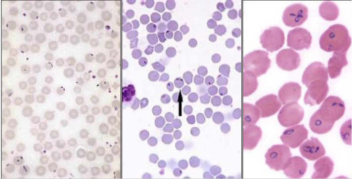 <p>Why did this animal succumb to babesia divergens and not others that were reared on the same farm?</p>