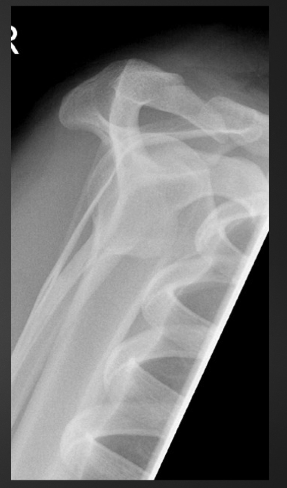 <p>what is this anomaly called </p>