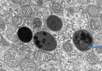 <p>spherical membrane bound vesicle produced by golgi body, contains hydrolytic enzymes, same function as vacuole, enzymes break down waste</p>