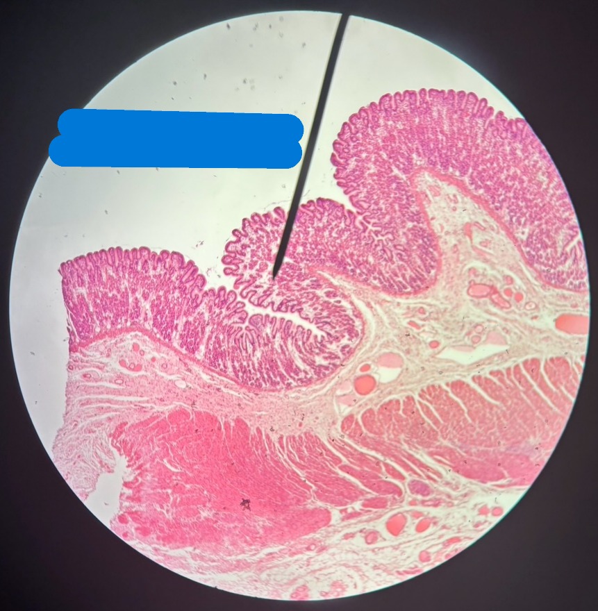 <p>Organ?</p><p>What is the name of the glands in mucosa layer?</p><p>Possibly transition from this organ to another may indicate what structure?</p>