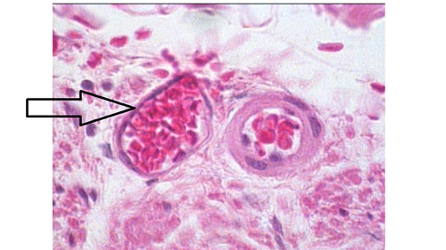 <p>Identify the structure at the arrow?</p>