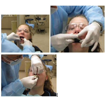 <p><span><strong>1. Mandibular arch </strong></span></p><p><span><strong>2. Maxillary arch</strong></span></p>