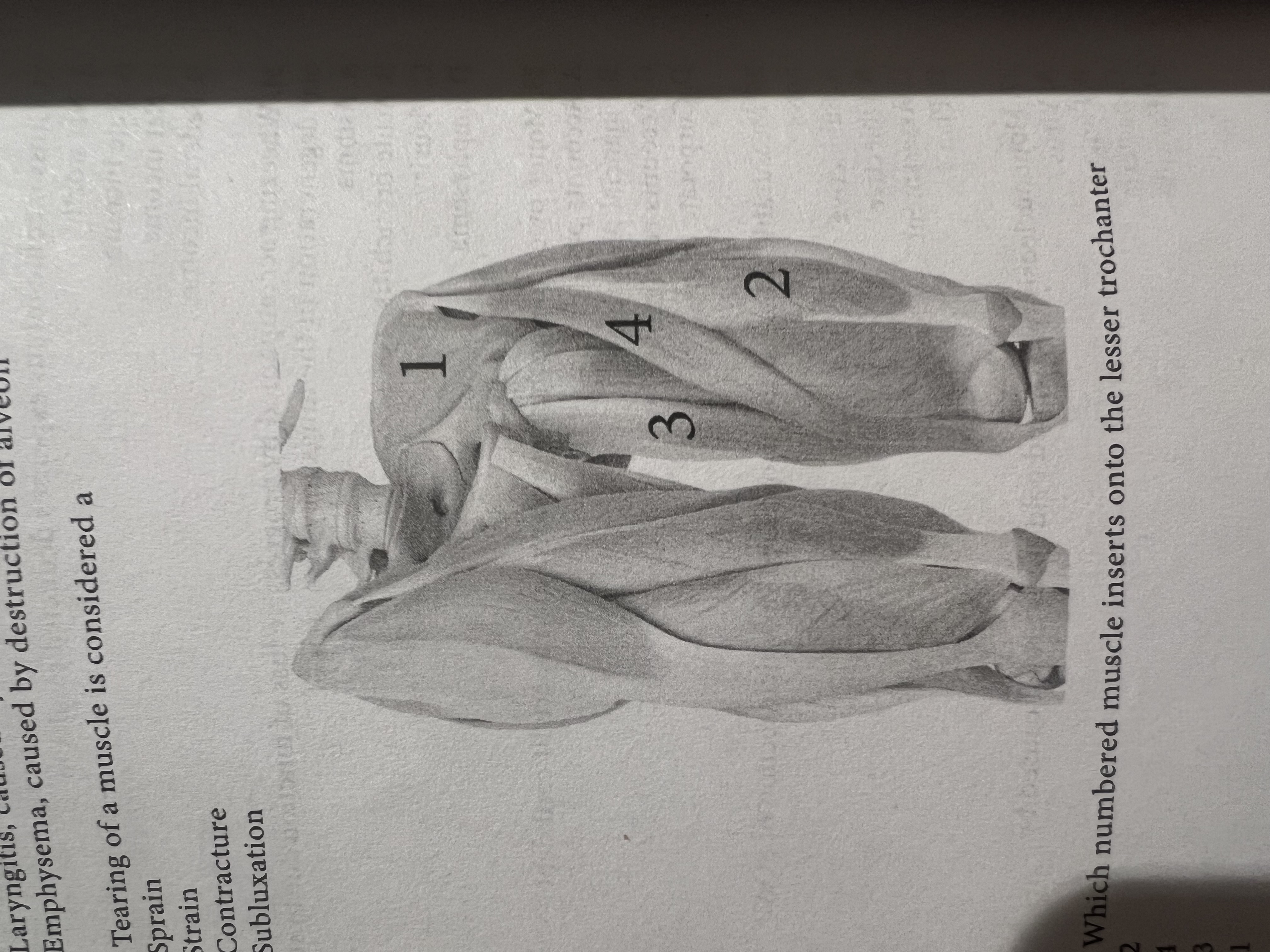 <p>Which numbered muscle inserts into the lesser trochanter</p>