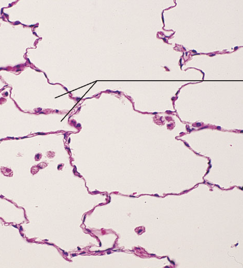 <p>What tissue type does this image depict?</p>