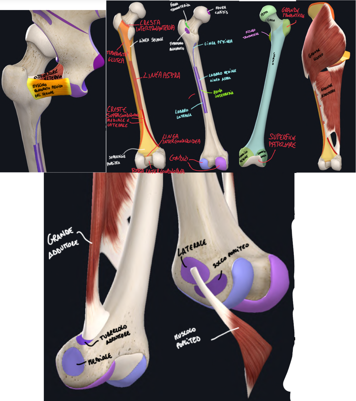 <p>CORPO:</p><ul><li><p>Superficie anteriore → liscia e leggermente convessa</p></li><li><p>Superficie posteriore → dal piccolo trocantere scende la linea spirale, mentre dal grande scende la tuberosità glutea → queste scendono e continuano lungo il corpo come LINEA ASPRA che a sua volta continua cresta sopracondiloidea mediale e laterale verso il basso (e tra questa la superficie poplitea)</p></li><li><p>La linea aspra è formata da labbro mediale e laterale, sedi di inserzione muscolare, mentre la tuberosità glutea è sede di inserzione del grande gluteo e adduttore.</p></li></ul><p>ESTREMITA’ DISTALE:</p><ul><li><p>Abbiamo il Condilo Mediale e Laterale</p></li><li><p>Anteriormente tra i condili abbiamo la superficie patellare che si articola con la Patella</p></li><li><p>Posteriormente tra i condili abbiamo la fossa intercondiloidea con la linea intercondiloidea superiormente.</p></li><li><p>Poi ancora più ai lati, abbiamo l’Epicondilo Mediale e Laterale.</p><ul><li><p>Il mediale presenta il tubercolo adduttore per il muscolo grande adduttore </p></li><li><p>Mentre il laterale presenta il solco per il muscolo popliteo.</p></li></ul></li></ul><p></p>