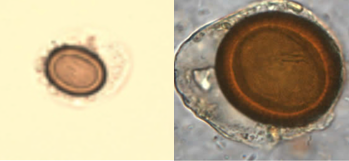 _____________ egg in iodine-stained wet mount.