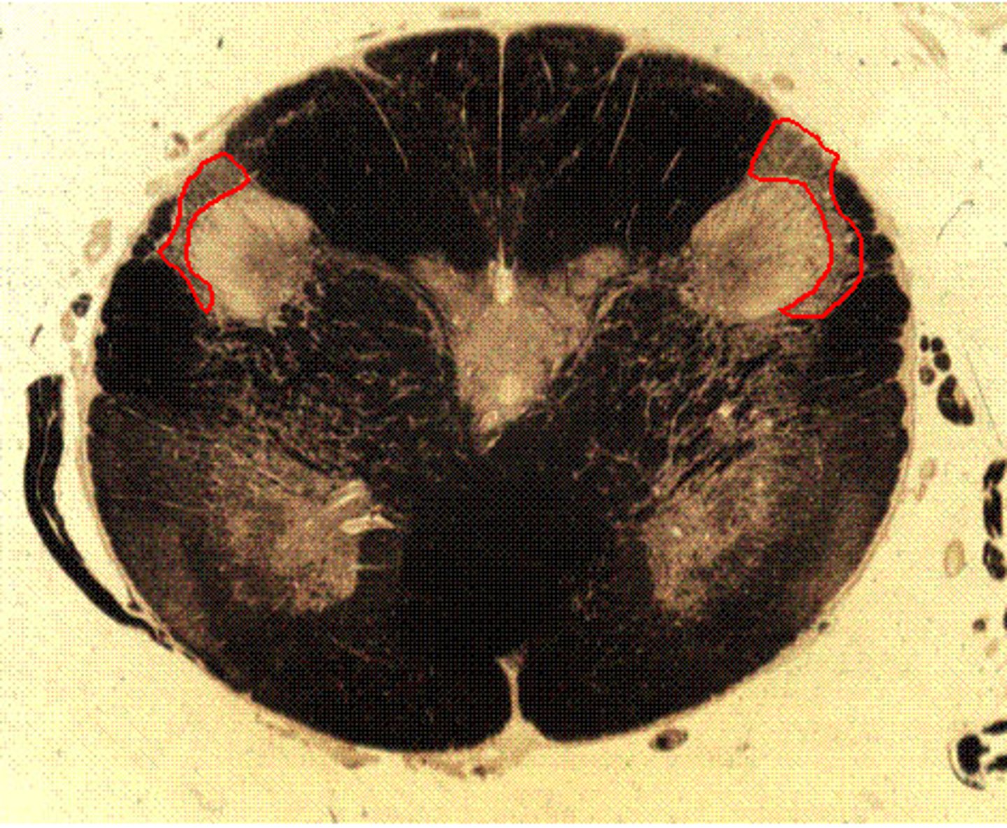 <p>[Darker]</p>