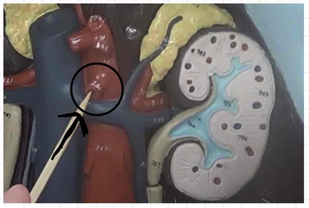 <p>what is this? (torso model)</p>