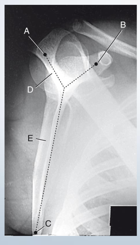 <p>Spapular Y Lateral</p>