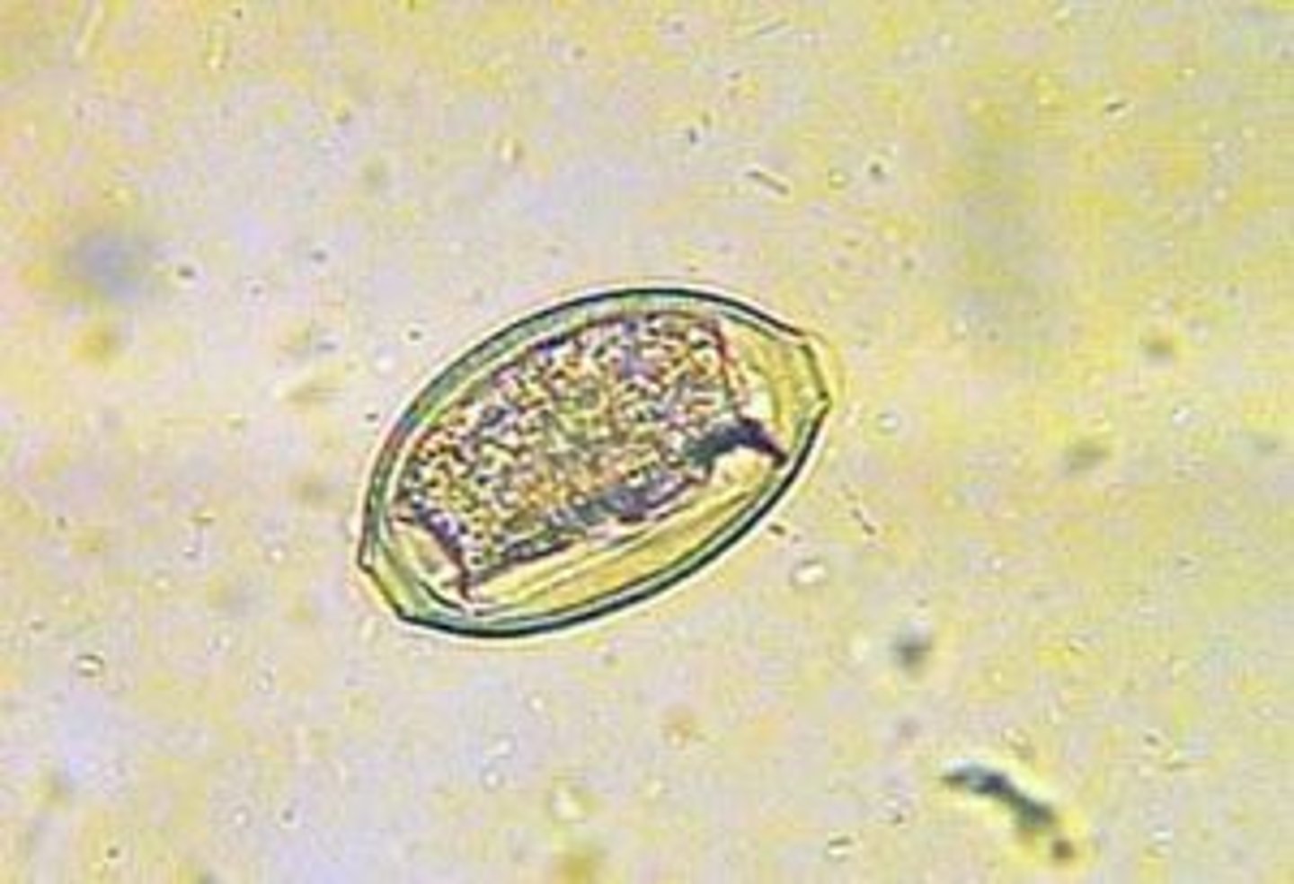 <p>bladder worm of felines and canines</p>