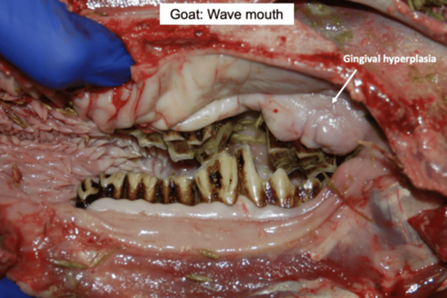 <p>- Wave mouth and step mouth</p>