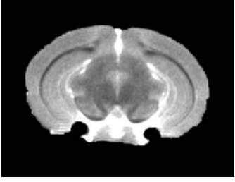 Coronal T2-weighted MR image of mouse hippocampus