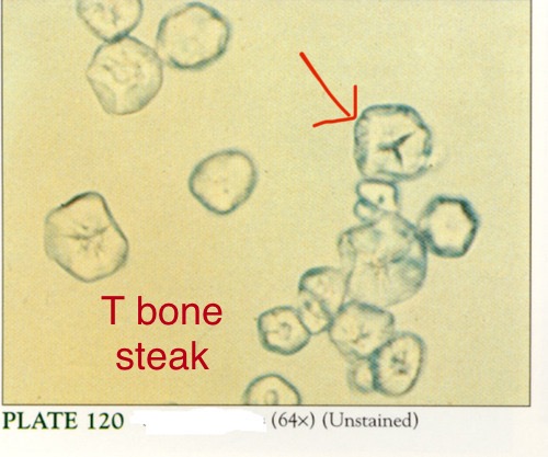 <p>What do you see in this image?</p><p>Is it clinically significant?</p><p>Acidic or Alkaline?</p><p>What can it indicate?</p>