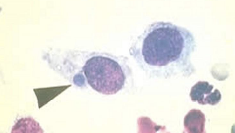 <p>C. psittaci will be observed in what cells obtained from smears in the exudate or organs? Serology, PCR, and tissue isolation are also used to diagnose it.</p>