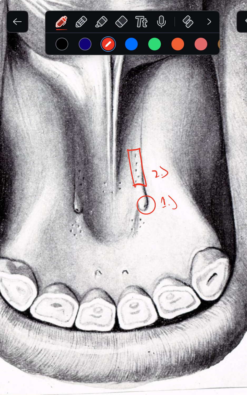 <p>label the structures indicated in the oral cavity</p>