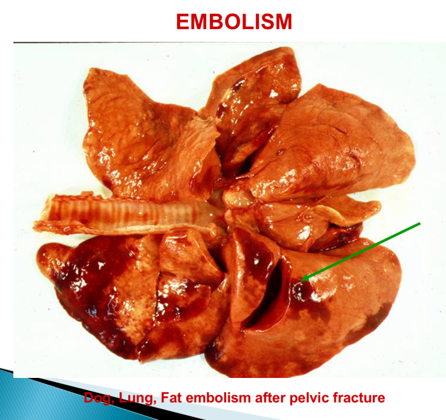 <p>What can happen after fractures </p>