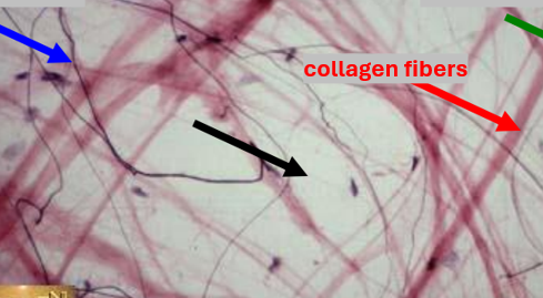 <p>What is the BLACK arrow pointing at?</p>