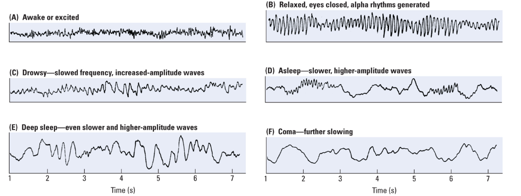 <p>The higher the frequency of the EEG, the more active the brain is. </p>
