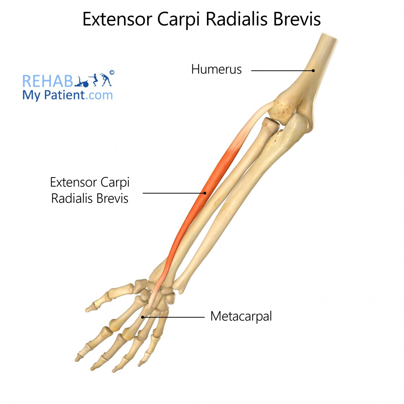 <p>Runs from the lateral epicondyle to the base of the third metacarpal; extends and abducts the wrist.</p>