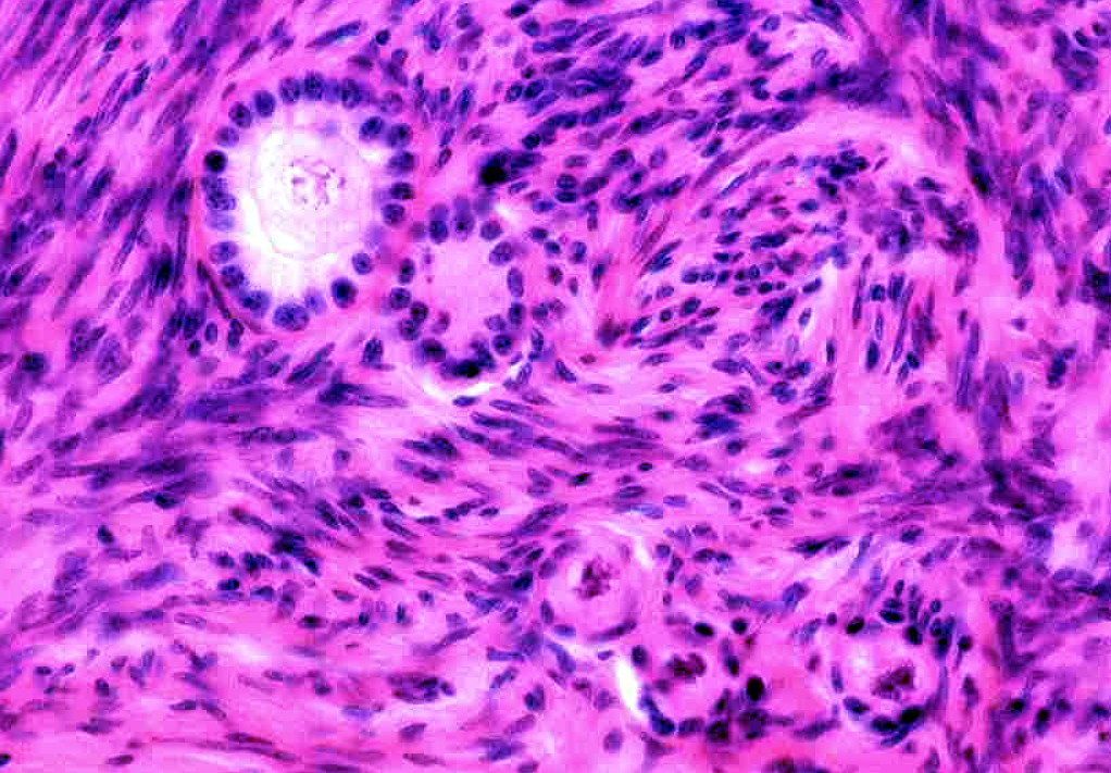 <p><span style="font-size: large">Observe the histological pattern of this specimen and select the correct identification from the list.</span></p><p><span style="font-size: large">a) epididymis</span></p><p><span style="font-size: large">b) ovary</span></p><p><span style="font-size: large">c) prostate gland</span></p><p><span style="font-size: large">d) testis</span></p><p><span style="font-size: large">e) uterus</span></p>