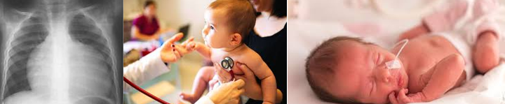 <ul><li><p class="">Most commonly seen in Congenital Heart Disease</p></li><li><p class="">Most cases occur by <u>6 months of age</u>.</p></li><li><p class=""><strong>Cannot Pump Blood Effectively:</strong></p><ul><li><p class="">Reduced cardiac output</p></li><li><p class="">Hypertrophy</p></li></ul></li><li><p class=""><strong>Signs &amp; Symptoms:</strong></p><ul><li><p class=""><strong><em>Sweating during feeds**</em></strong></p></li><li><p class="">Poor feeding</p></li><li><p class=""><strong><em>Increased work of breathing (WOB)/respiratory distress**</em></strong></p></li><li><p class="">Decreased urine output</p></li></ul></li><li><p class=""><strong>Poor Cardiac Output:</strong></p><ul><li><p class="">Low BP</p></li><li><p class="">Tachycardia</p></li><li><p class="">Gallop heart rhythm</p></li><li><p class=""><strong><em>Cool, pale skin**</em></strong></p></li></ul></li><li><p class=""><strong>Fluid Overload:</strong></p><ul><li><p class=""><strong><em>Edema**</em></strong></p></li><li><p class=""><strong><em>Crackles in lungs**</em></strong></p></li></ul></li></ul><p><strong>Nursing Care</strong></p><ul><li><p><strong>Monitor:</strong></p><ul><li><p class="">Vital signs (V/S), ECG, and cardiac status</p></li><li><p class="">Intake &amp; output (I &amp; O), daily weights</p></li></ul></li><li><p class=""><strong>Promote Rest:</strong></p><ul><li><p class="">Cluster care to minimize stress</p></li></ul></li><li><p class=""><strong>Provide Adequate Nutrition:</strong></p><ul><li><p class=""><strong>Infant Nutrition:</strong></p><ul><li><p class="">Feed every 3 hours when rested; hold in a semi-upright position</p></li><li><p class="">Allow rest during feedings; gavage feed if unable to consume milk</p></li><li><p class="">Increase caloric density of feeds</p></li><li><p class="">Encourage breastfeeding mothers to alternate with high-density formula or fortified breast milk</p></li></ul></li></ul></li></ul><p></p>