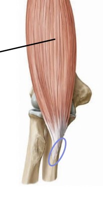 <p>coronoid process of ulna </p>