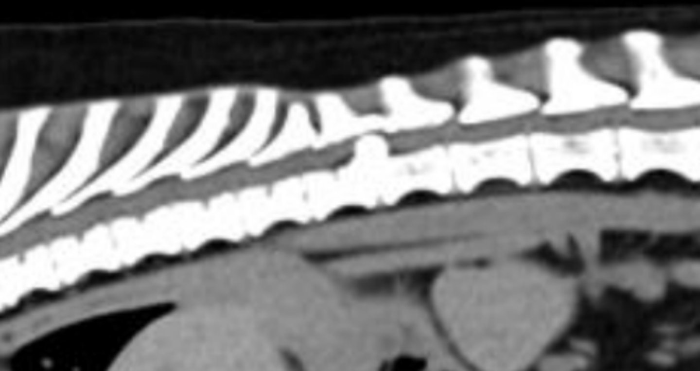 <p>- CT or MRI (can see the spinal cord being pressed on)</p>