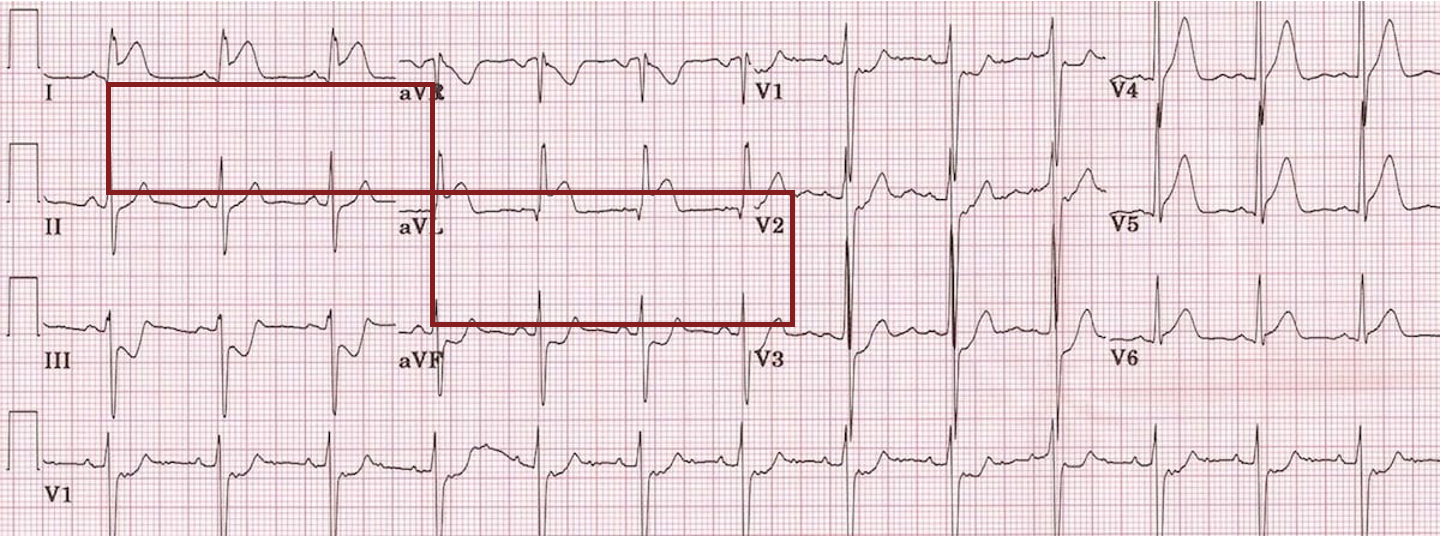 <p>what is this?</p>