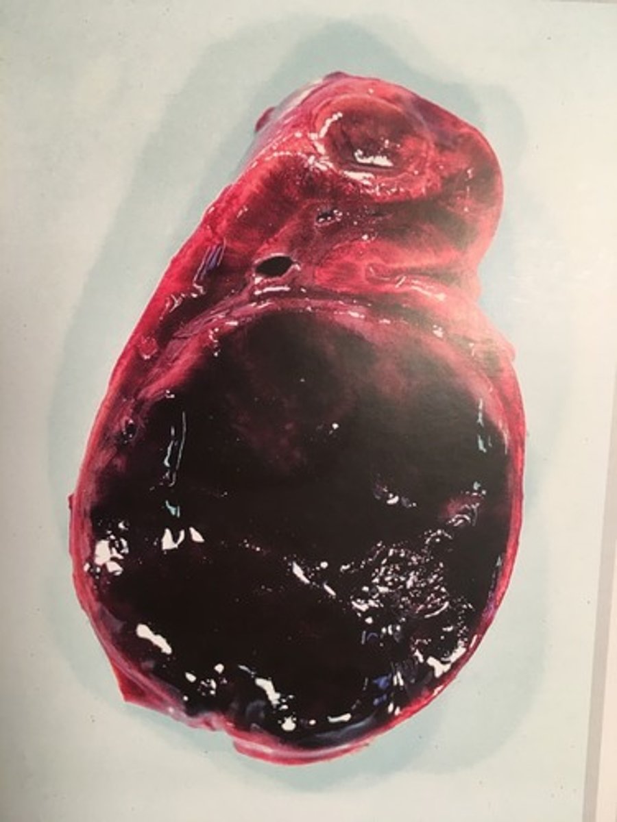 <p>Adrenal kirtel (binyrer) fra hest, hvad er den patoanatomiske diagnose?</p>