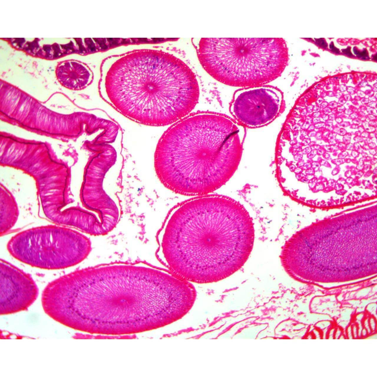 <ul><li><p>Observe a wide variety of cells, tissues, and organisms</p></li><li><p>Staining can be used for enhanced viewing</p><p>Disadvantages</p></li><li><p>Limited view of living organisms ( only a single cell layer)</p></li><li><p>Thicker samples require staining, which kills the sample</p></li></ul><p></p>