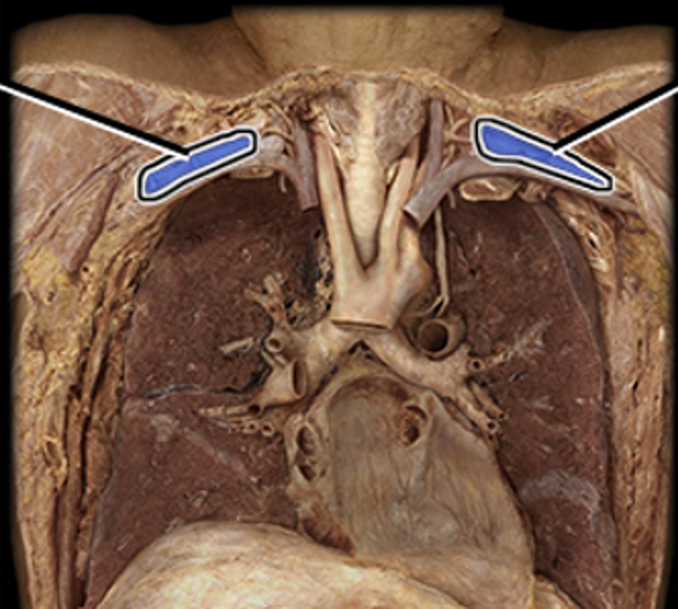 <p>Supplies blood to structures within the axillary, shoulder and pectoral regions.</p>