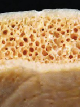 <p>What is the top part with holes?</p>