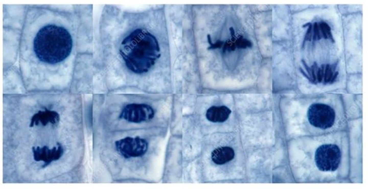 <p>The nuclear envelope/membrane.</p>