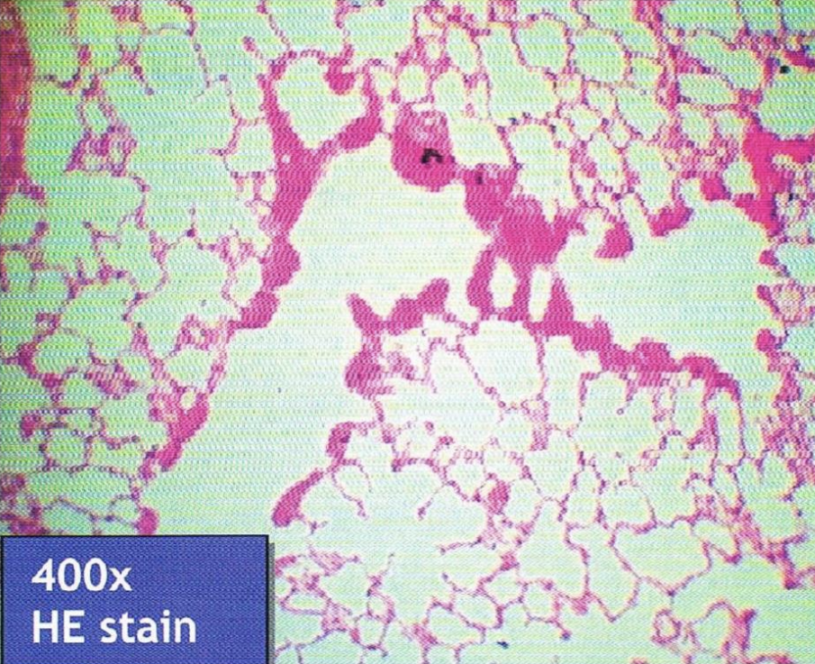 <p>Identify the structure and LE</p>