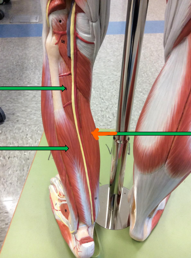 <p>Identify this muscle?</p>