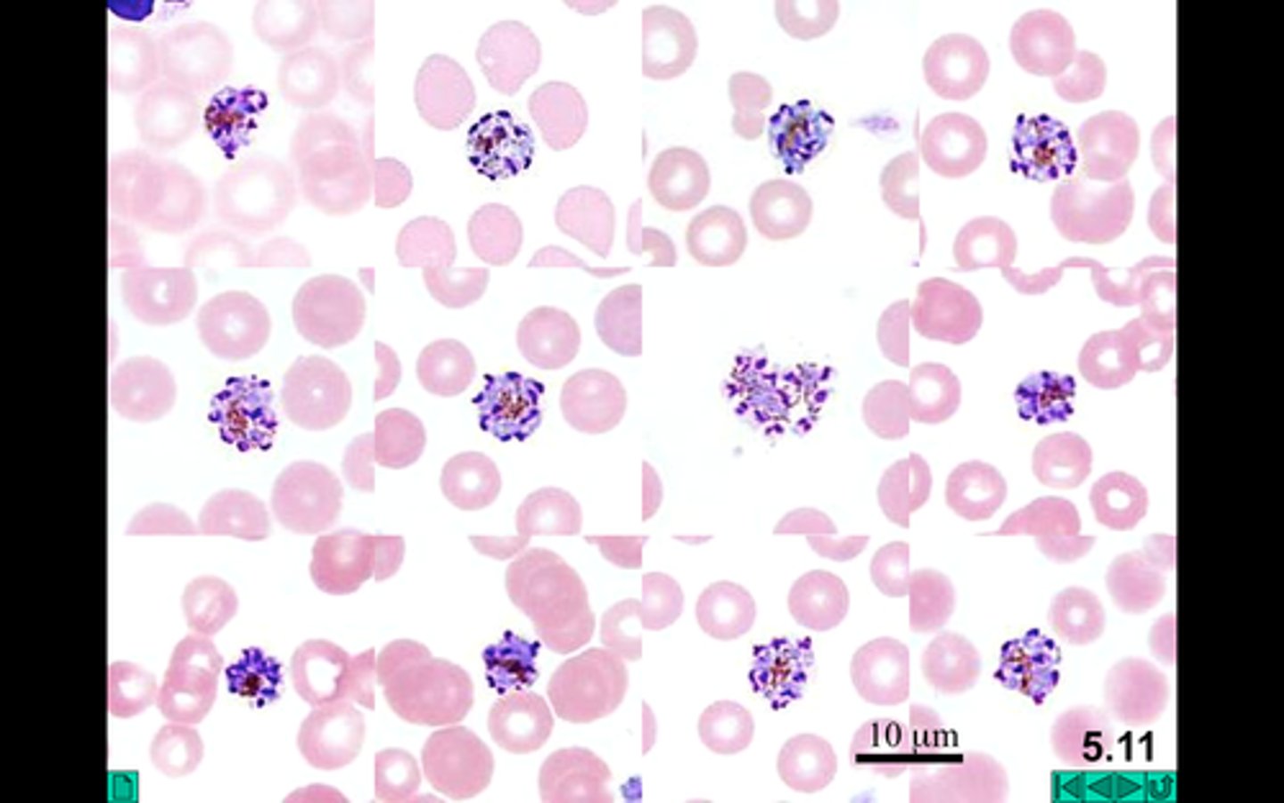 <p>Name the stage and species.</p><p>NOTE: Note 6-12 merozoites around the cell.</p>