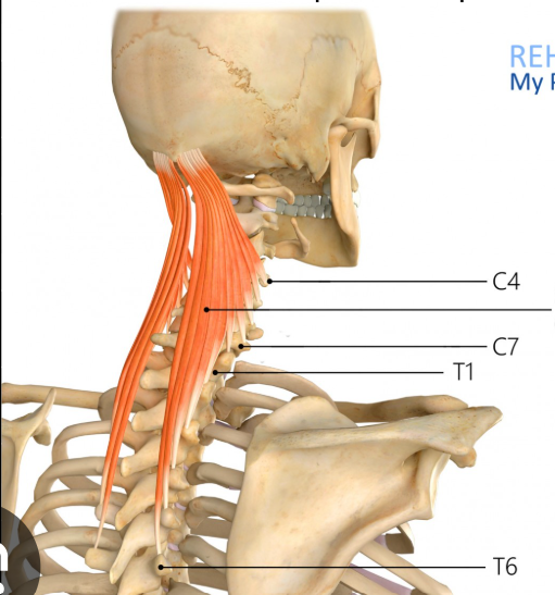 <p>Origin: Tips of the transverse processes of the upper 6-7 thoracic vertebrae and vertebra C07 and from the articular processes of vertebrae C04-C06.</p><p>Insertion: Between the superior and inferior nuchal lines of the occipital bone</p><p>Innervation: Dorsal rami of the spinal nerves</p><p>Action: Extension of the spine; extension and lateral flexion of the neck</p>