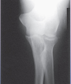 <p>What is the projection, anatomy and position shown?</p>