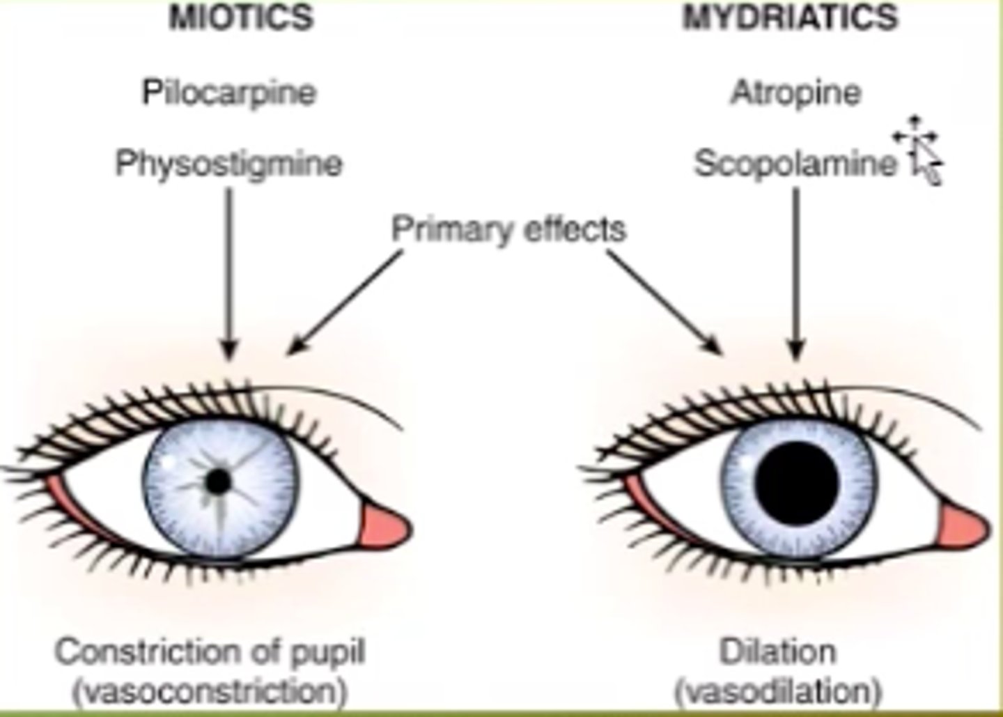 <p>A. Miotics</p><p>* Constricts the pupil</p><p>* Used for decreasing IOP in angle closure glaucoma by increasing aqueous humor outflow via the trabecular meshwork pulling the peripheral iris which blocks the trabeculum.</p>
