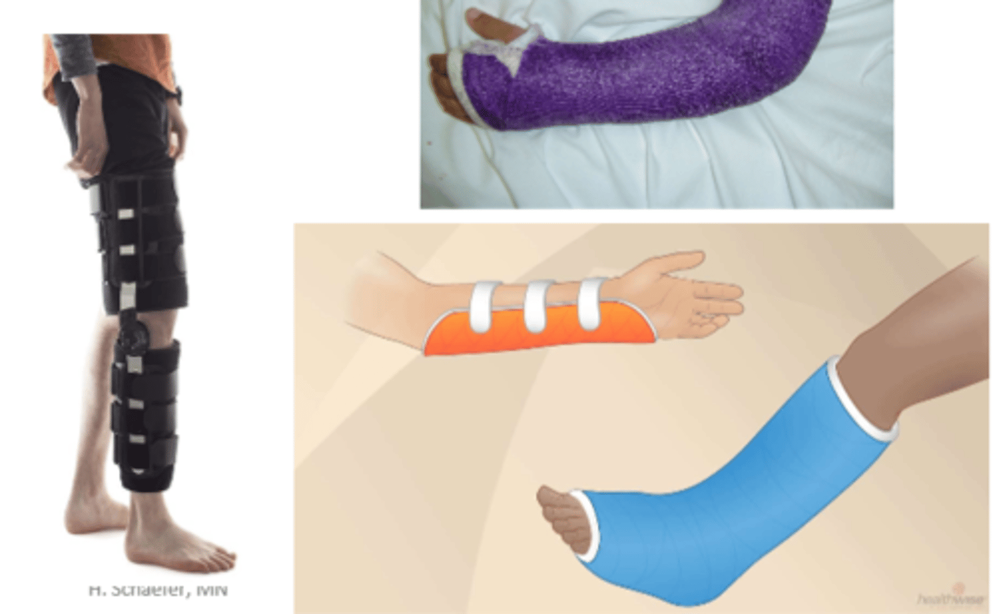 <p>- rehab exercises</p><p>- physiotherapy</p><p>- occupational therapy</p><p>- note: early mobility prevents clot formation</p>