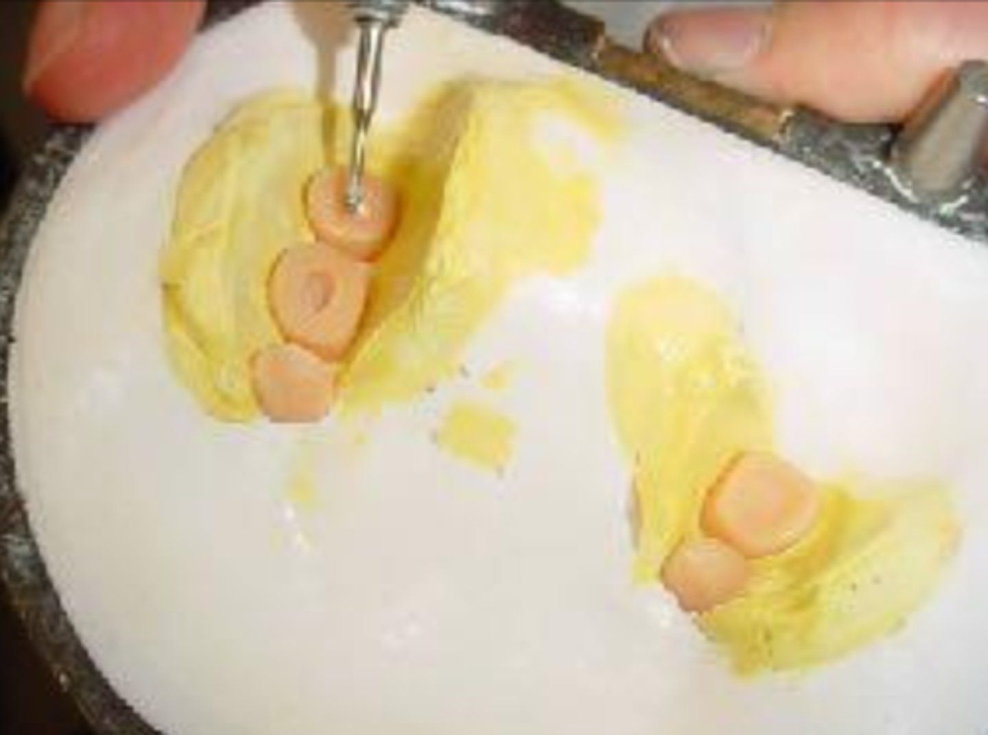 <p>During the wax elimination processing of the denture for the cold packing technique, what is placed at the bottom of denture teeth?</p>