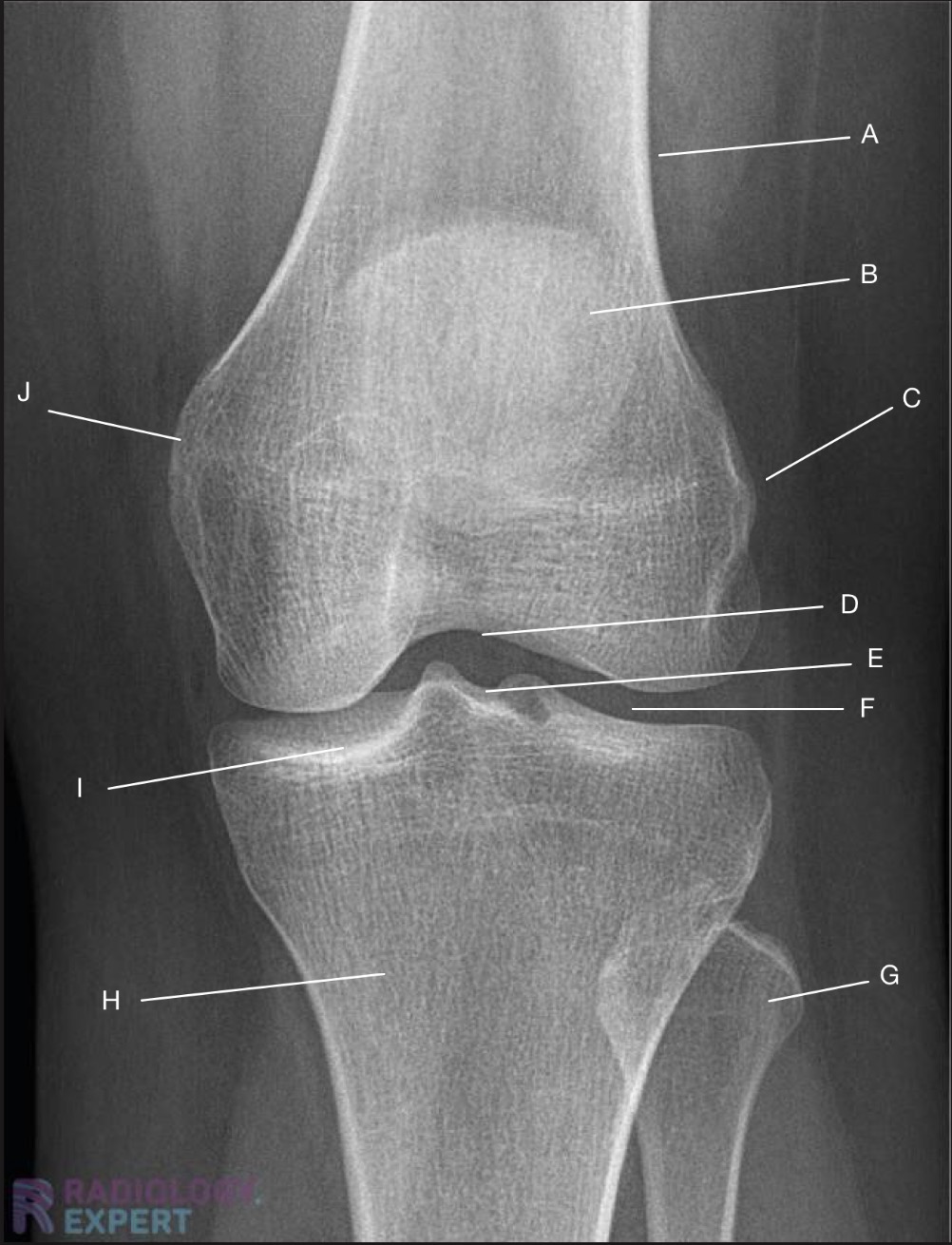 <p>Name the projection.</p><p>Should it be repeated, if so why?</p>