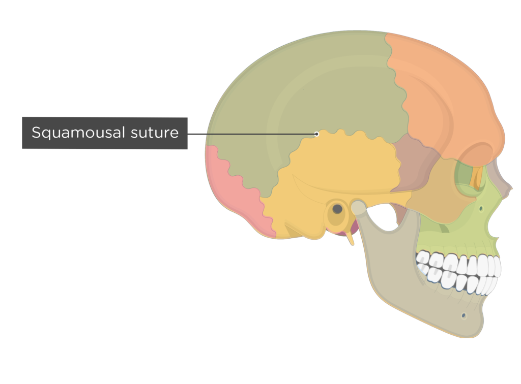 <p>[BONES TO KNOW; suture] separates the <u>temporal bone</u> from the <u>parietal bones</u>.</p>