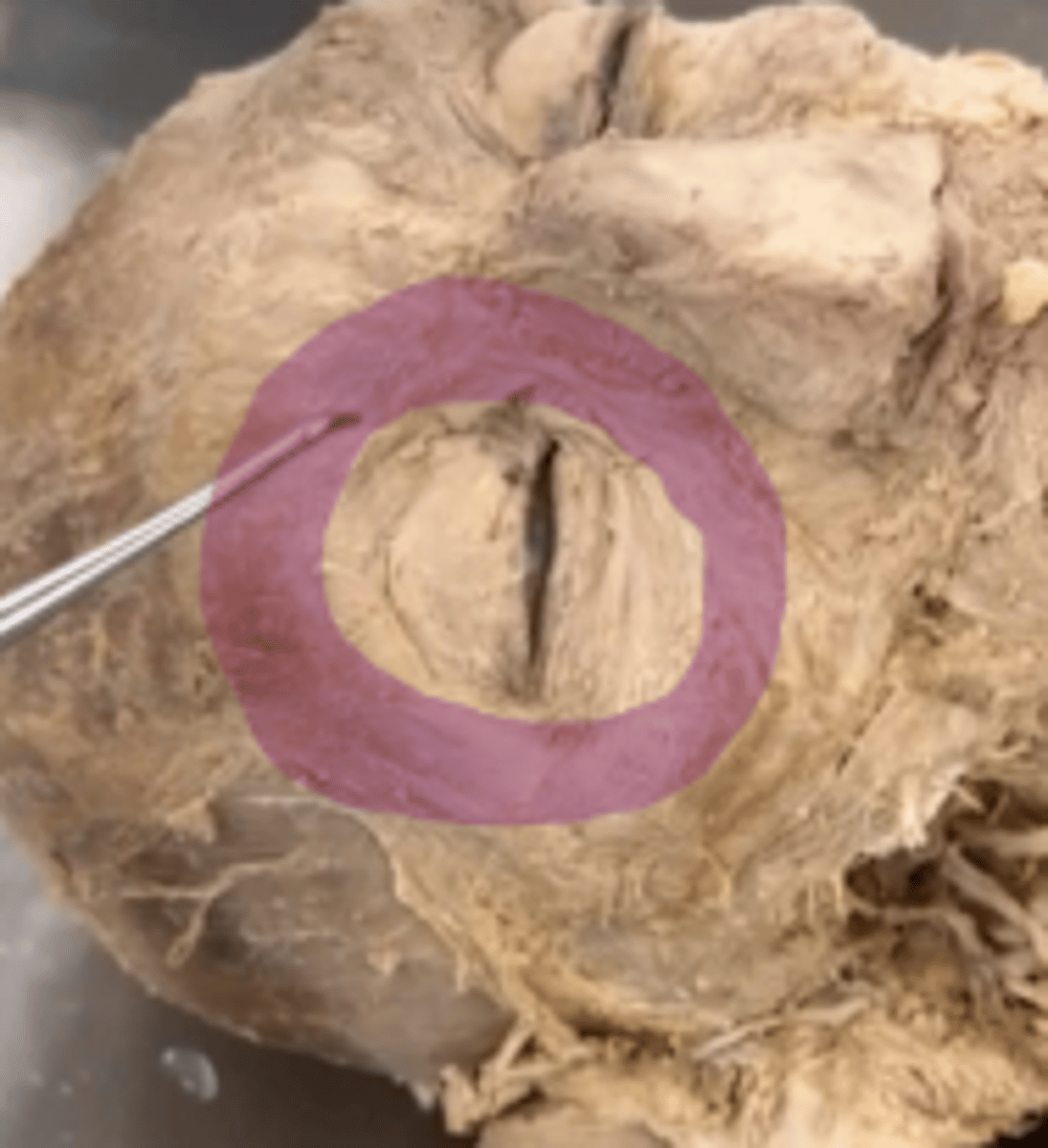 <p>Name the muscle.</p>